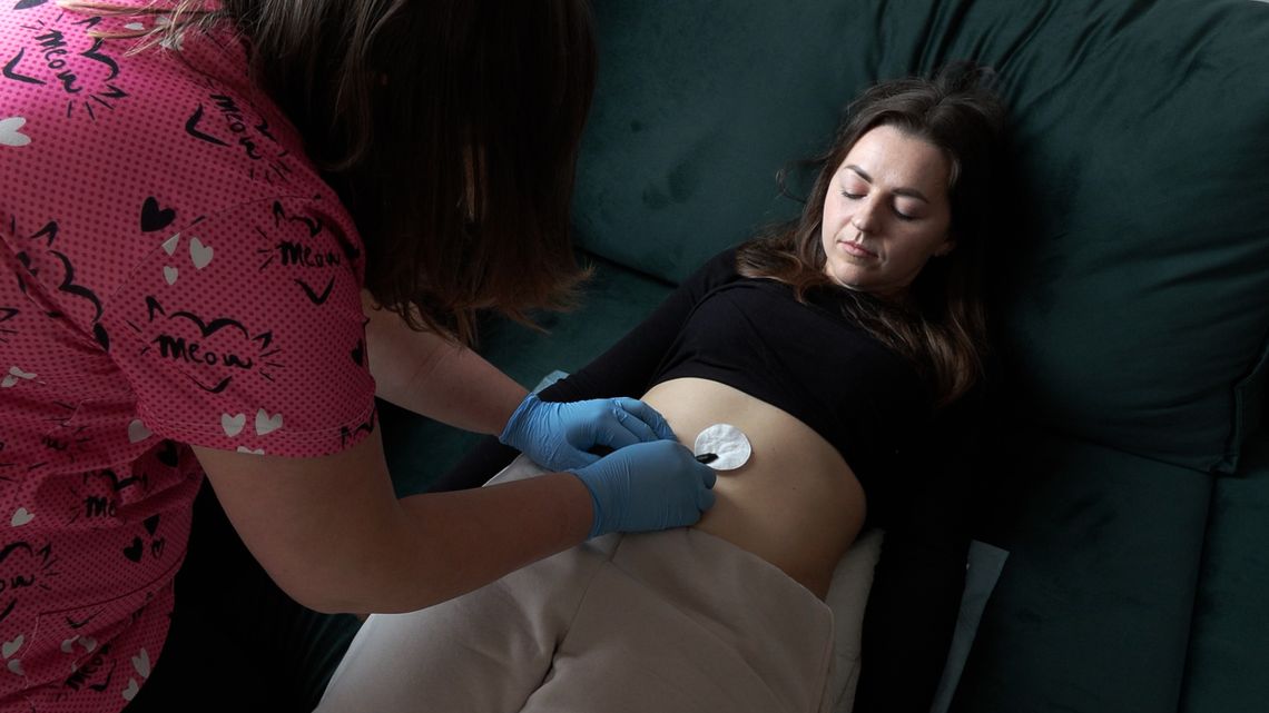 Pijawki lekarskie wracają do łask – sprawdź, jak mogą pomóc Tobie!